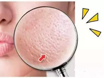 熬夜会毛孔增大吗，如何改善