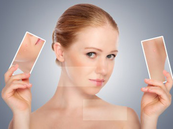 用竹炭面膜会毛孔粗大吗  竹炭面膜 美白祛黄 第2张