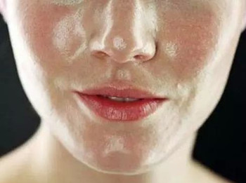 油性皮肤和干性皮肤的区别，分别怎么护理