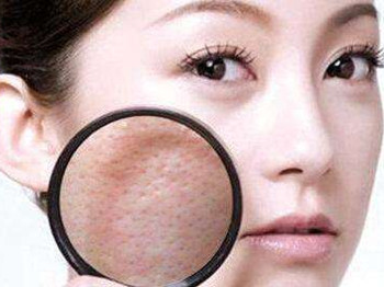 油性皮肤毛孔粗大用盐水洗可以吗