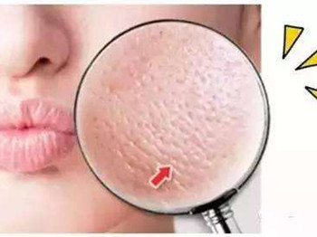 魅魔毛孔收细精华液怎么样  收缩毛孔 魅魔 美白祛黄 第2张