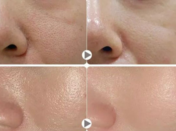 魅魔毛孔收细精华液怎么样  收缩毛孔 魅魔 美白祛黄 第3张