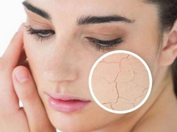 外油内干毛孔粗大长痘怎么调理