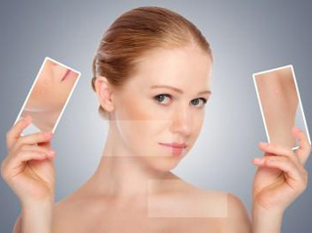 面部毛孔粗大的原因，全面分析6大原因  毛孔粗大 美白祛黄 第6张