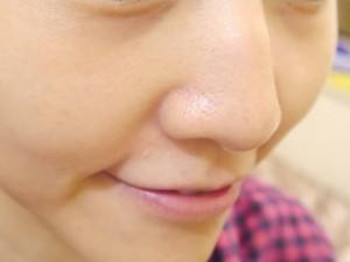 鼻子两侧毛孔粗怎么办，针对原因解决  收缩毛孔 美白祛黄 第2张