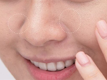 鼻子两侧毛孔粗怎么办，针对原因解决  收缩毛孔 美白祛黄 第4张