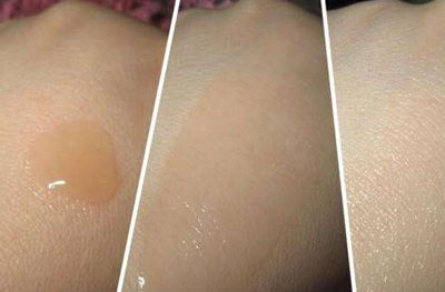 为什么用完雅诗兰黛精华脸上会刺痛，怎么解决