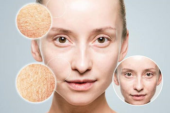 脸上一擦隔离防晒就痒怎么回事，怎么改善  隔离防晒 脸痒 美白祛黄 第2张