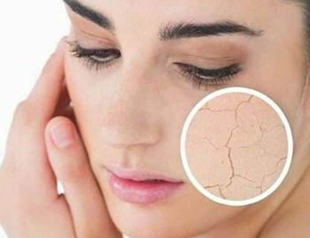 脸上起皮发痒干燥紧绷怎么办