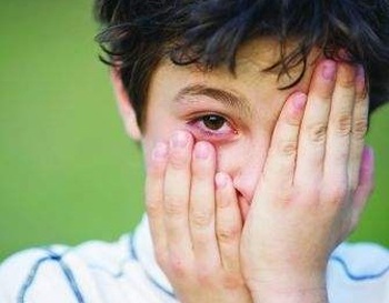 眼霜过敏有什么症状，教你正确识别眼霜过敏  眼霜 过敏 美白祛黄 第5张