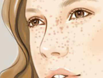 皮肤肤色不均的原因，如何改善  肤色不均 美白祛黄 第3张