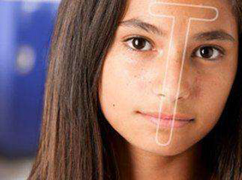 油性肌肤和混合性肌肤的区别，分析两点  混合性 油性 美白祛黄 第2张