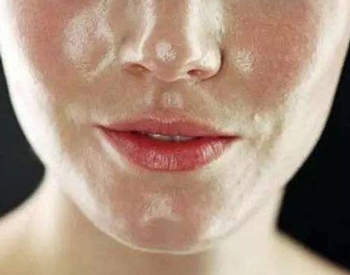 油性皮肤好还是干性皮肤好，肤质大比拼  油性皮肤 干性 美白祛黄 第3张