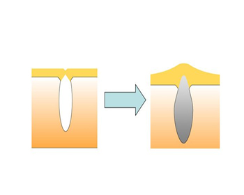 不护肤和护肤的区别，看肌肤如何保养才对  护肤 美白祛黄 第3张