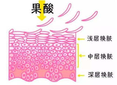 鸡皮肤用果酸还是水杨酸哪个好  果酸 水杨酸 美白祛黄 第4张