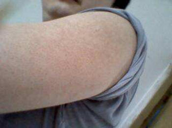 鸡皮肤不能吃什么，四大禁忌