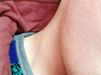 脸部毛周角化症怎么治，四种解决方法  脸部 美白祛黄 第4张