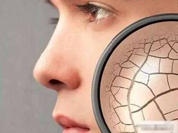 鸡皮肤越来越严重了怎么办  去鸡皮肤 美白祛黄 第2张