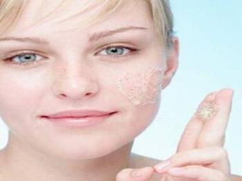 鸡皮肤越来越严重了怎么办  去鸡皮肤 美白祛黄 第4张