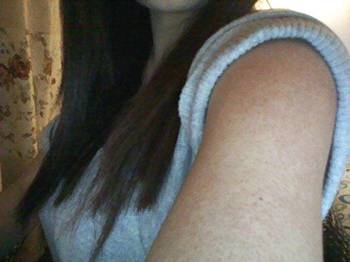 毛囊角化症会传染吗