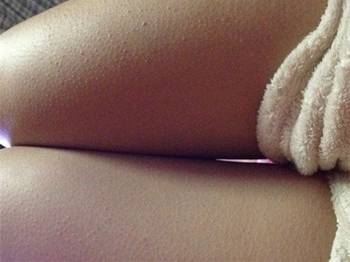 大腿内侧鸡皮疙瘩很痒怎么回事