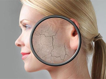 干性皮肤的症状，判断是否是干性皮肤