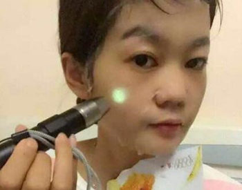 补水面膜会有荧光剂吗，怎样辨别是否有荧光剂  荧光剂 面膜 补水面膜 美白祛黄 第3张