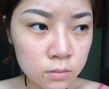 敷面膜脸上刺痛是怎么回事，如何解决  面膜 美白祛黄 第3张