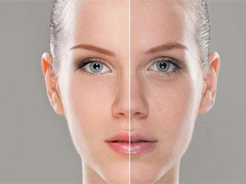 混合性皮肤适合用素颜霜吗  素颜霜 美白祛黄 第2张