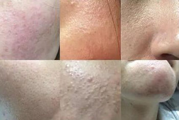 14天不洗脸修复皮脂膜管用吗  不洗脸 皮脂膜 美白祛黄 第4张