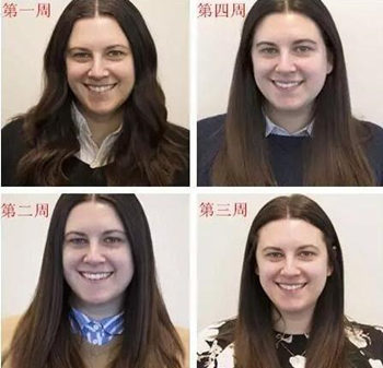 14天不洗脸修复皮脂膜管用吗  不洗脸 皮脂膜 美白祛黄 第5张