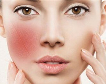 面色潮红可以修复好吗，如何修复最有效