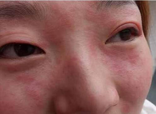 酒粕面膜用了脸**辣的正常吗，哪些人不适合用这面膜  酒粕面膜 美白祛黄 第4张