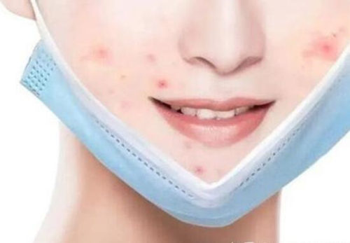 一次性口罩过敏小疙瘩会自己消失吗