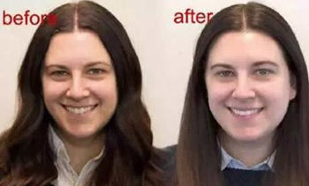 我5天没洗脸皮肤变好了是真好了吗  没洗脸 美白祛黄 第2张