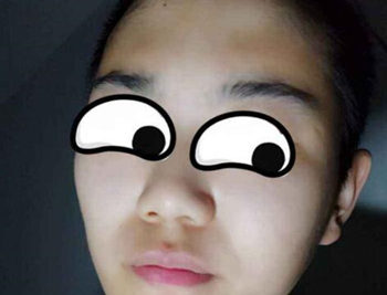 我5天没洗脸皮肤变好了是真好了吗  没洗脸 美白祛黄 第3张