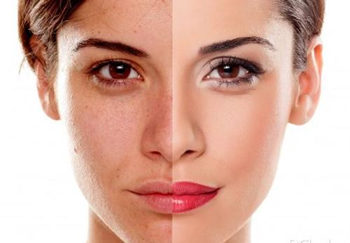 皮肤屏障修复好的表现都是哪些  皮肤屏障 美白祛黄 第5张