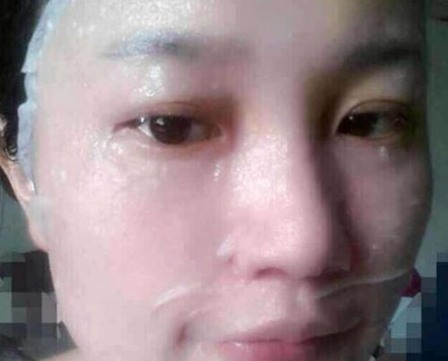 过敏性皮疹自己会好吗，一般多久会好  皮疹 过敏 美白祛黄 第5张