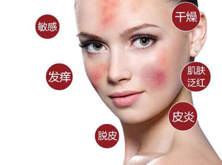 怎样区分混合型皮肤和敏感性皮肤  混合型皮肤 敏感性皮肤 美白祛黄 第4张