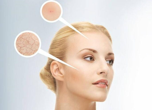 敏感肌肤会加速衰老吗，如何对抗衰老