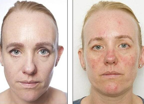 敏感肌肤会加速衰老吗，如何对抗衰老  衰老 美白祛黄 第2张