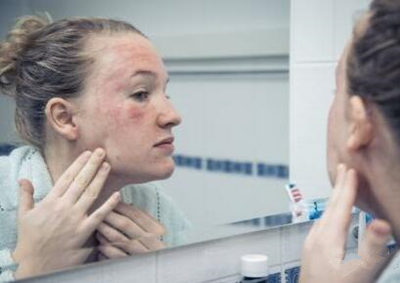 敏感肌怎么过冬，详细护肤攻略赶紧收藏