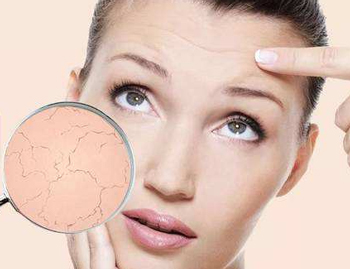 干性敏感肌症状，教你正确认识干性敏感肌