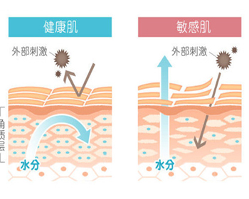 最新解析抗敏的正确护理方式