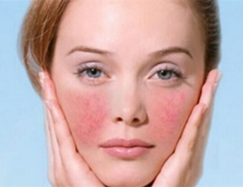 最新解析抗敏的正确护理方式  抗敏 美白祛黄 第3张