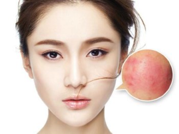 唯恩诗真真老师抗敏感肌肤专项讲堂