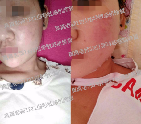 唯恩诗真真老师抗敏感肌肤专项讲堂  讲堂 专项 肌肤 美白祛黄 第5张