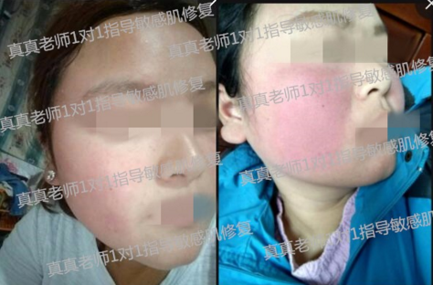 唯恩诗真真老师抗敏感肌肤专项讲堂  讲堂 专项 肌肤 美白祛黄 第6张