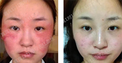 唯恩诗真真老师抗敏感肌肤专项讲堂  讲堂 专项 肌肤 美白祛黄 第7张