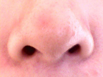 如何消除鼻翼两侧发红，学习5种方式